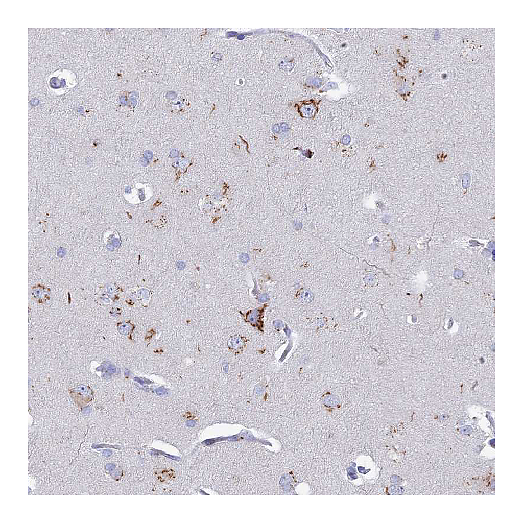 Atlas Antibodies Anti-HS2ST1 Antibody