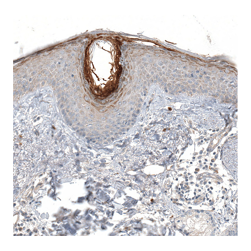 Atlas Antibodies Anti-HRNR Antibody