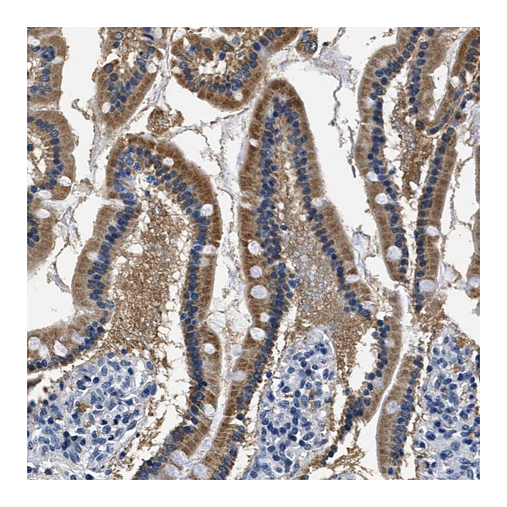 Atlas Antibodies Anti-HS3ST2 Antibody