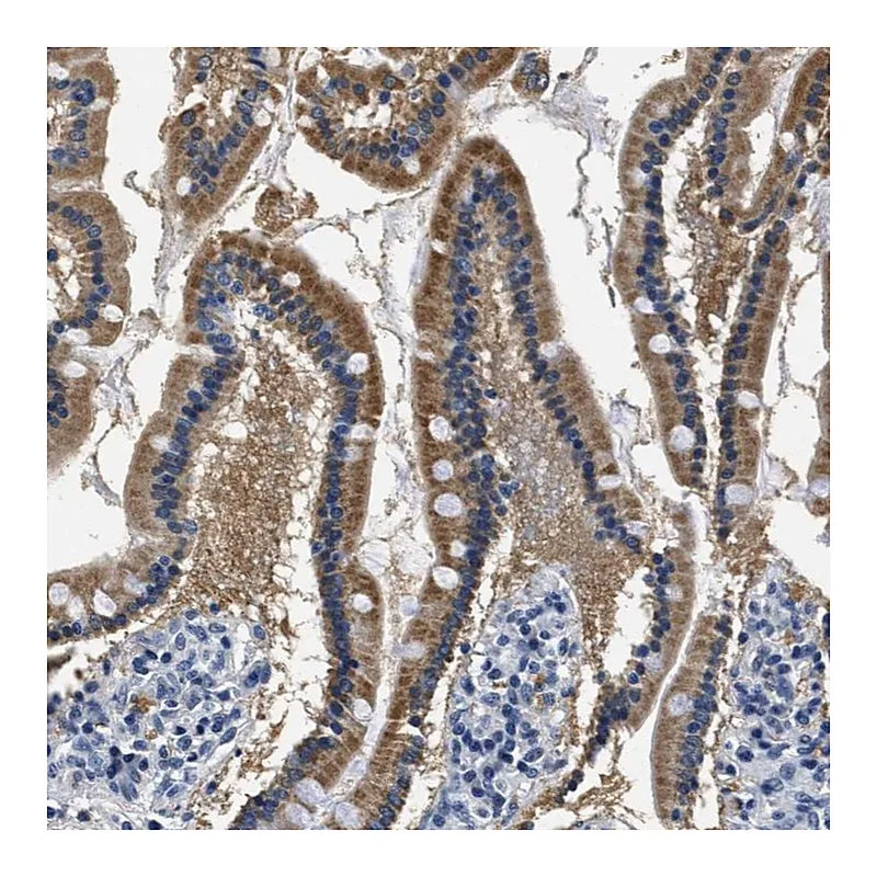 Atlas Antibodies Anti-HS3ST2 Antibody