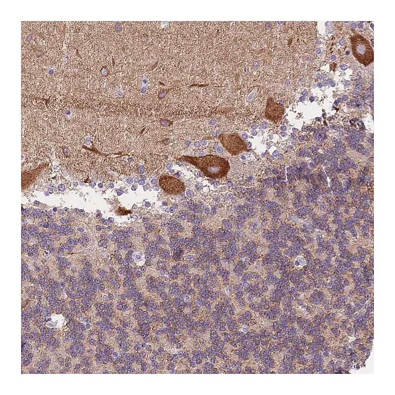 Atlas Antibodies Anti-HS3ST5 Antibody