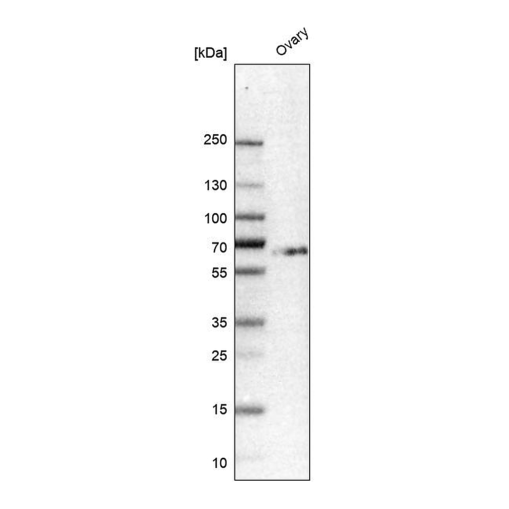 Atlas Antibodies Anti-HS6ST2 Antibody