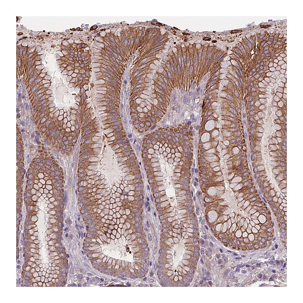 Atlas Antibodies Anti-HSBP1L1 Antibody