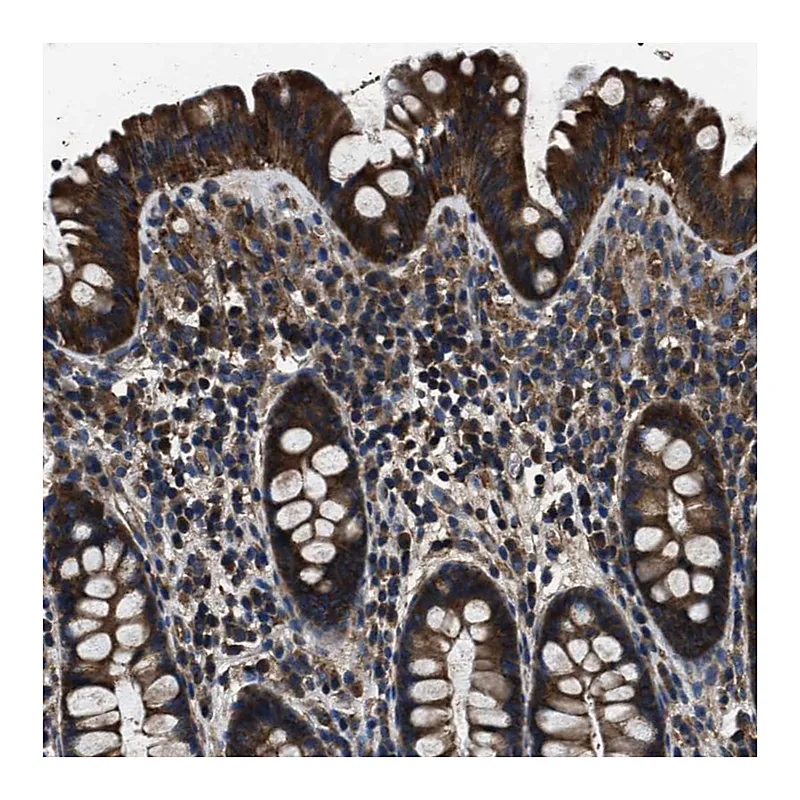 Atlas Antibodies Anti-HSCB Antibody