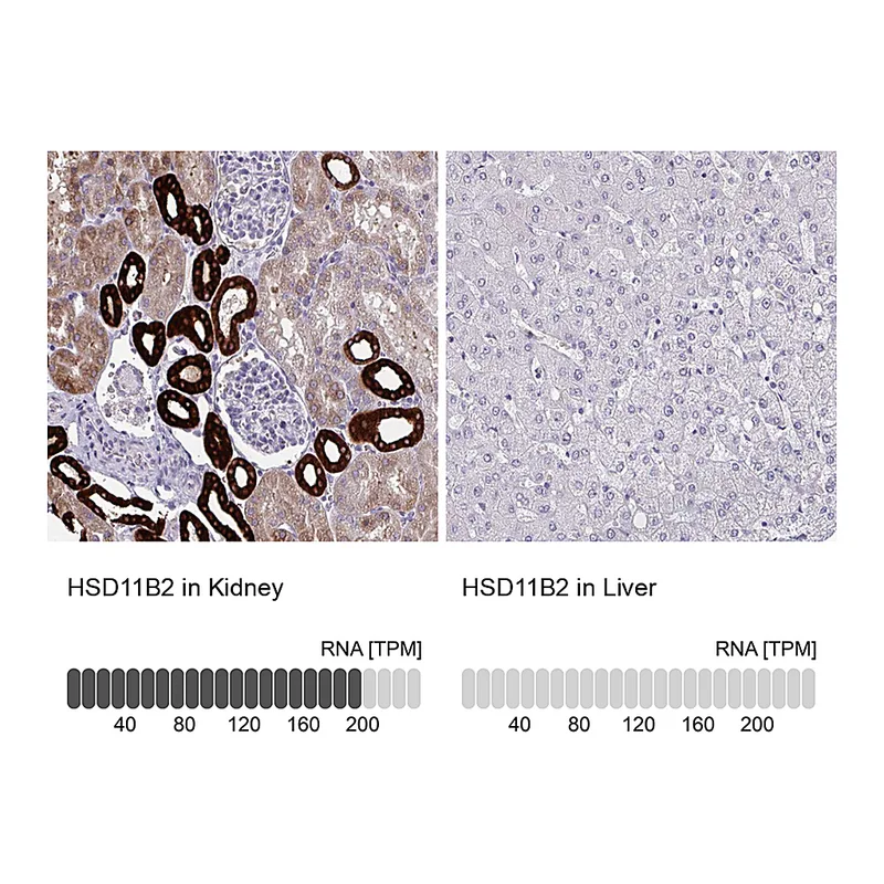 Atlas Antibodies Anti-HSD11B2 Antibody