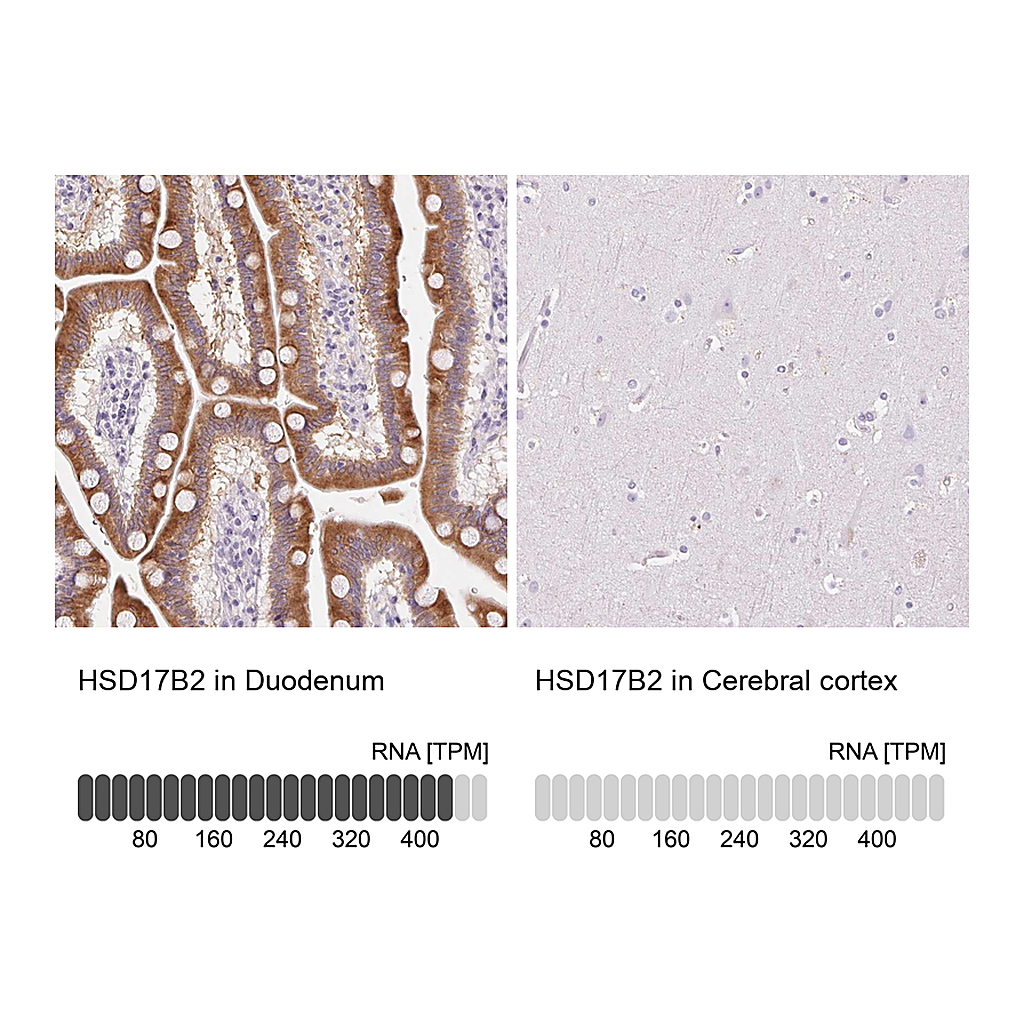 Atlas Antibodies Anti-HSD17B2 Antibody
