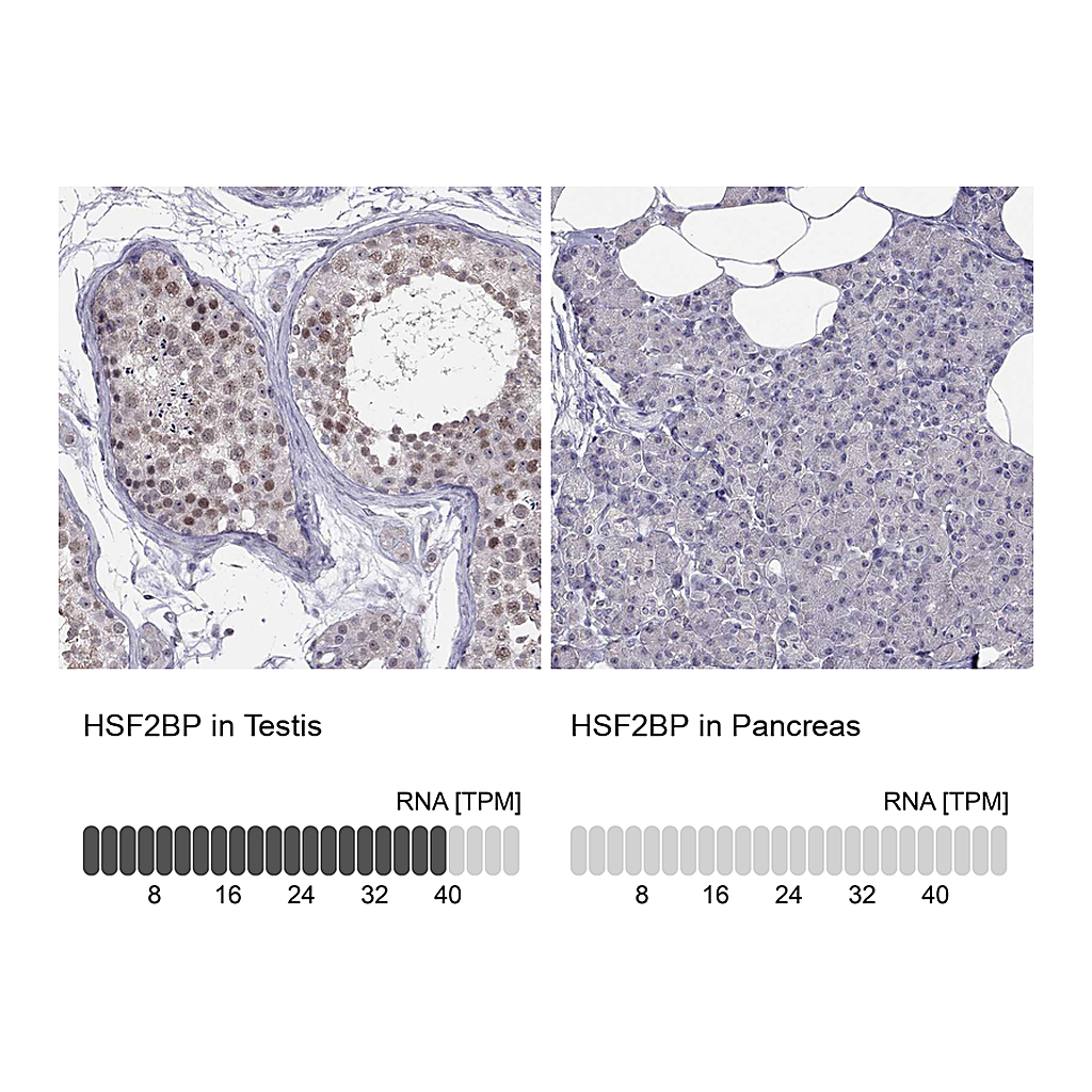 Atlas Antibodies Anti-HSF2BP Antibody