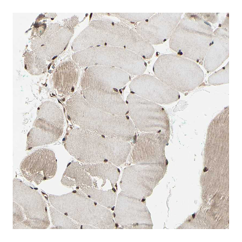 Atlas Antibodies Anti-HSF1 Antibody