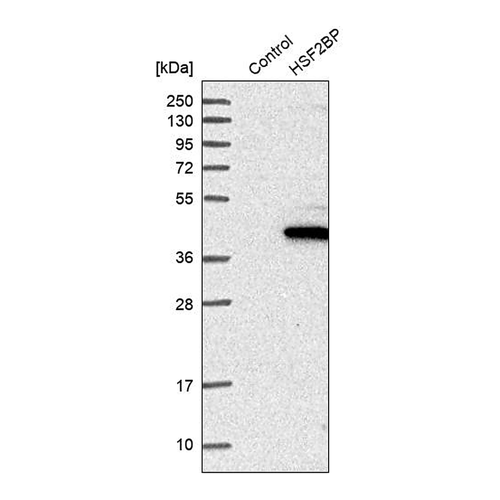 Atlas Antibodies Anti-HSF2BP Antibody