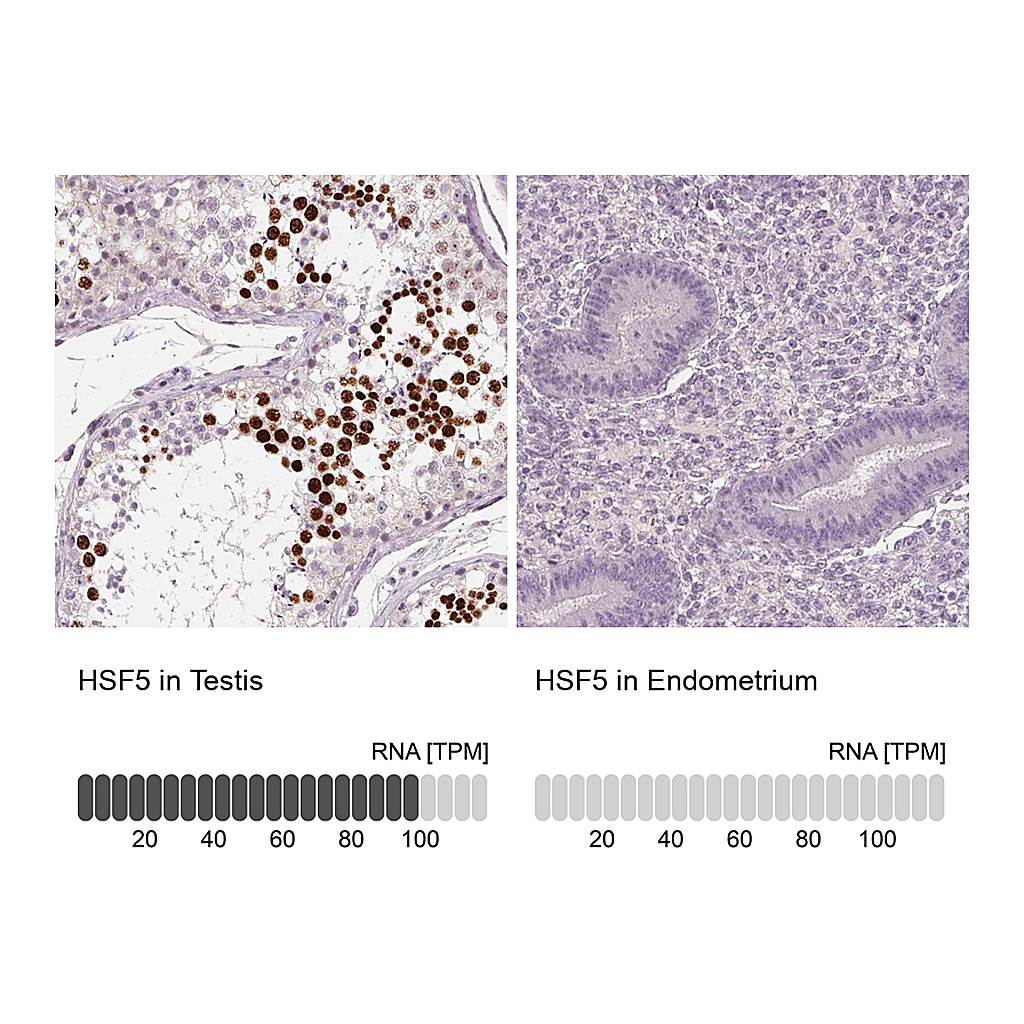Atlas Antibodies Anti-HSF5 Antibody