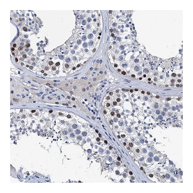 Atlas Antibodies Anti-HSF2 Antibody