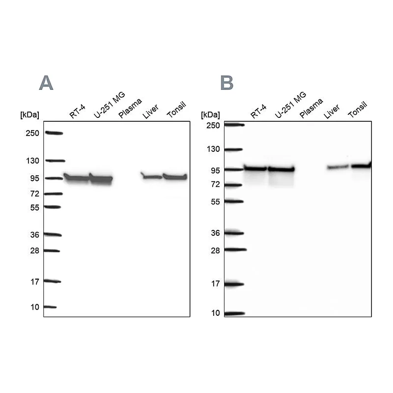 Atlas Antibodies Anti-HSP90AB1 Antibody