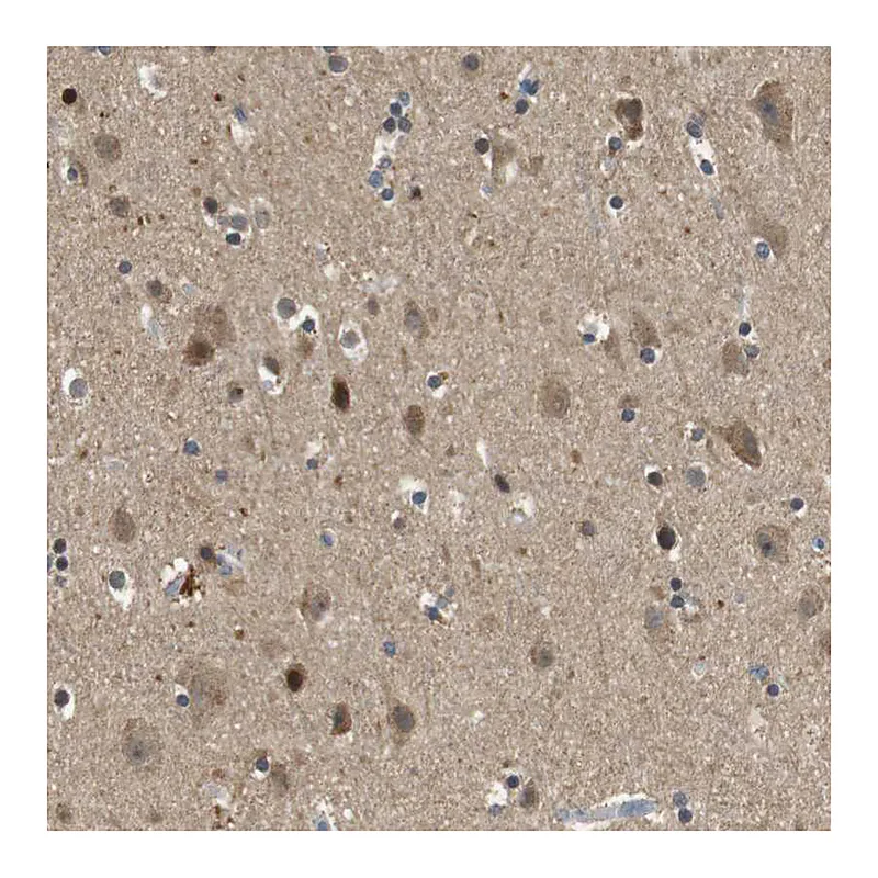 Atlas Antibodies Anti-HSPA13 Antibody