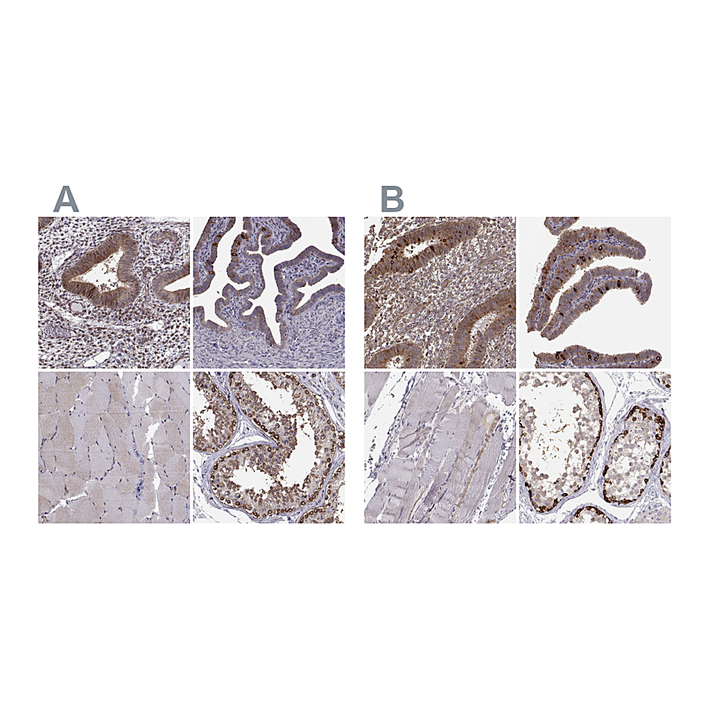 Atlas Antibodies Anti-HSP90AB1 Antibody