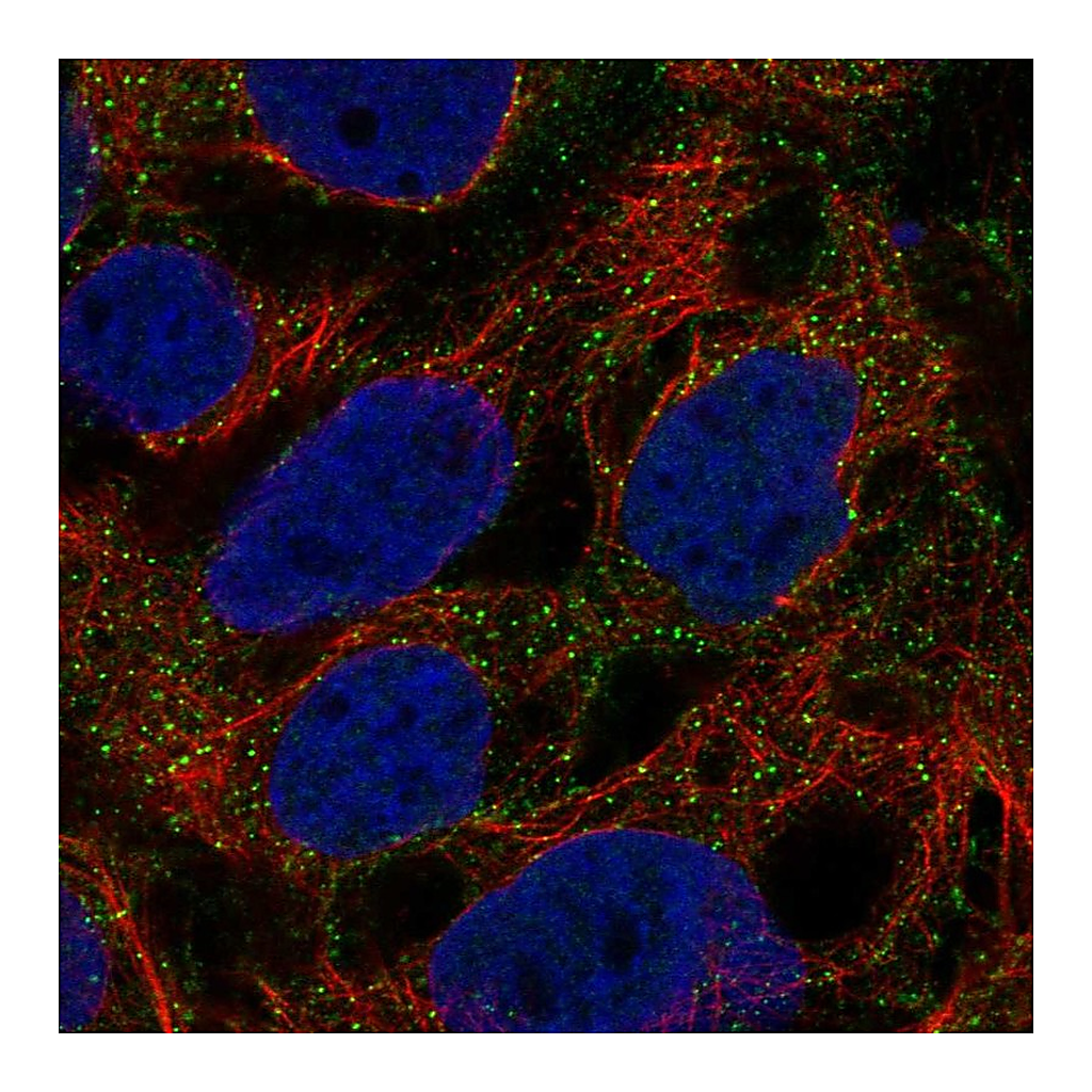Atlas Antibodies Anti-HSPA1A Antibody