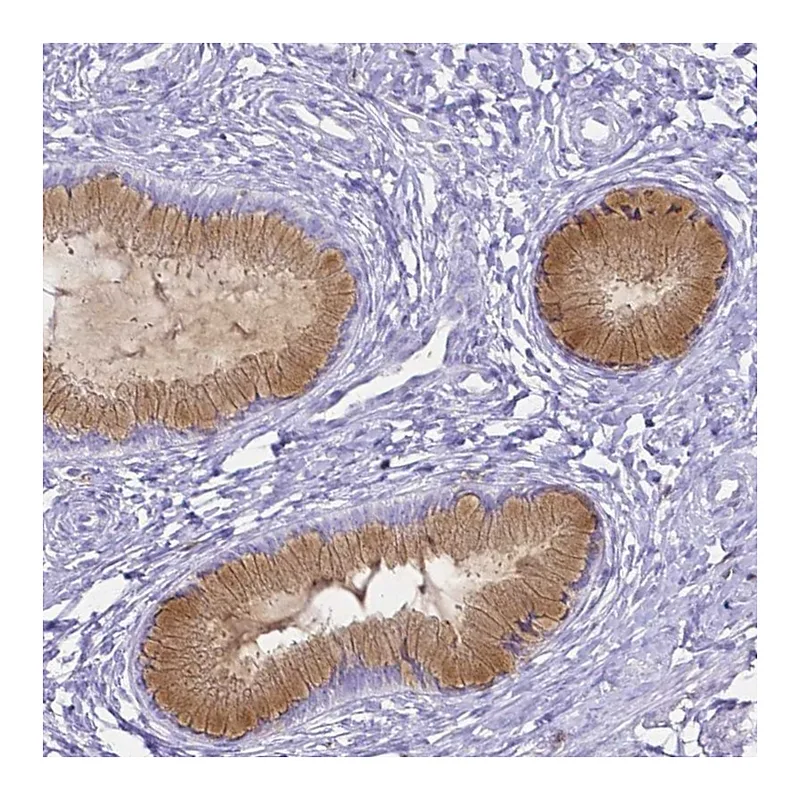 Atlas Antibodies Anti-HSPA12A Antibody