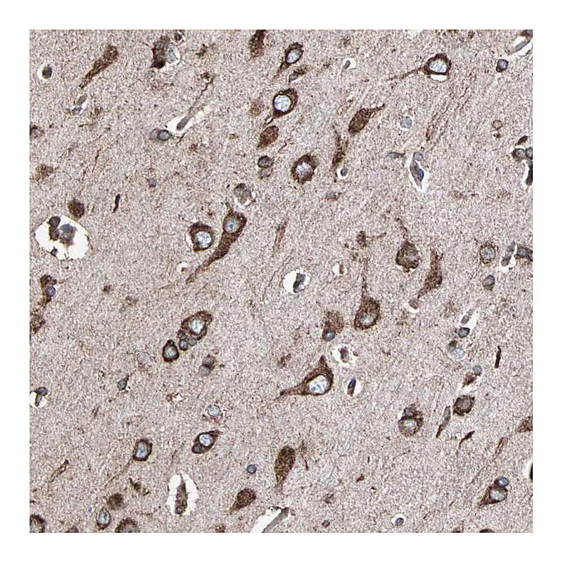 Atlas Antibodies Anti-HSP90B1 Antibody
