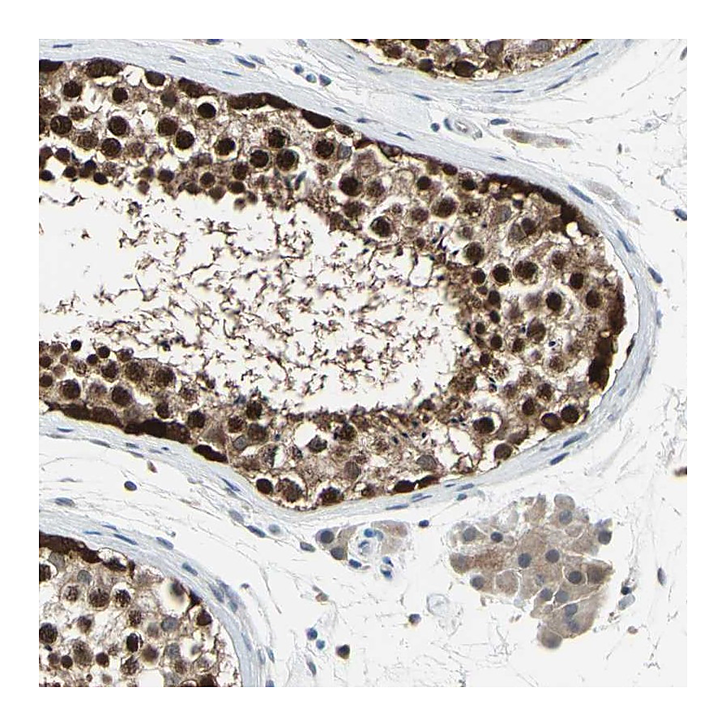 Atlas Antibodies Anti-HSPA4 Antibody