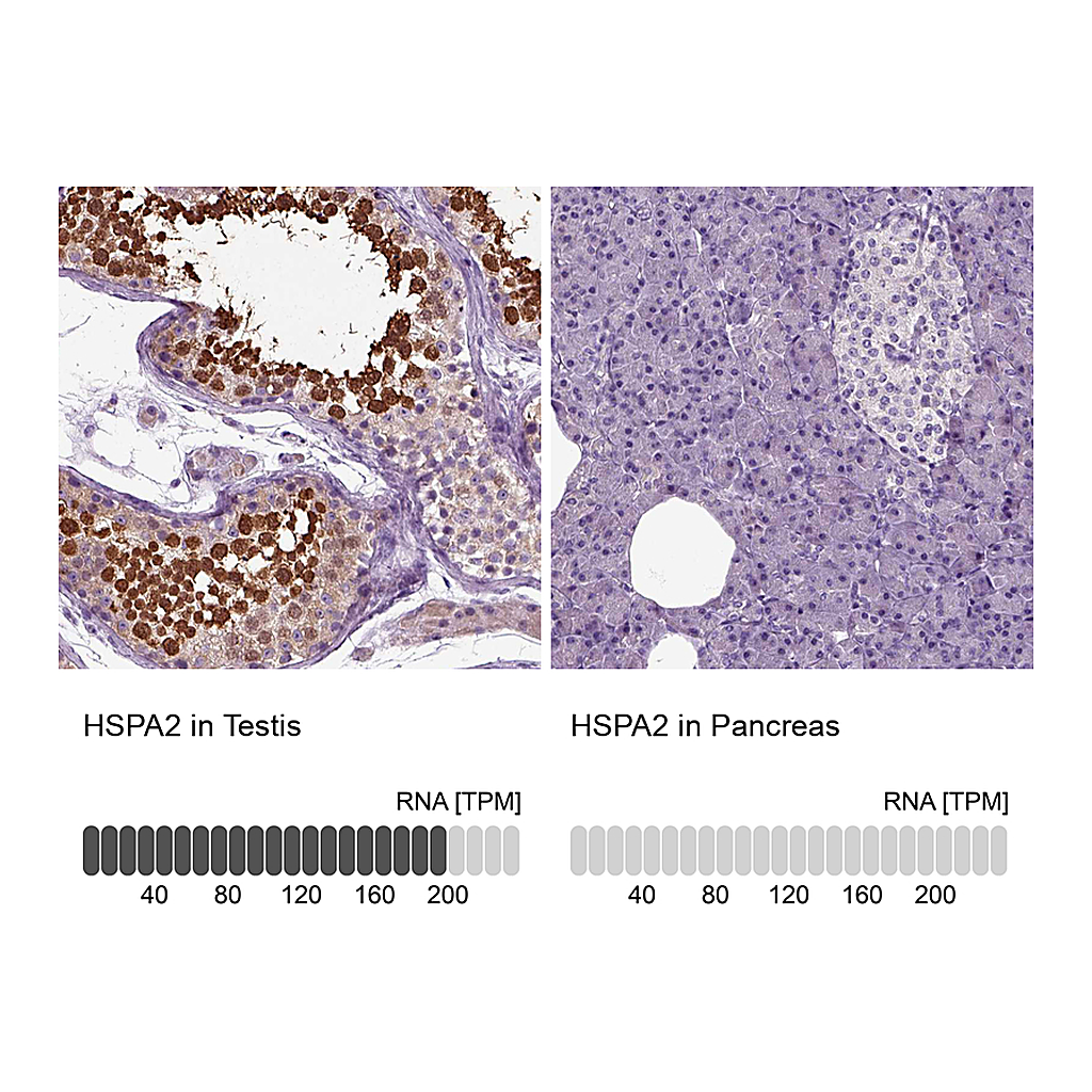 Atlas Antibodies Anti-HSPA2 Antibody