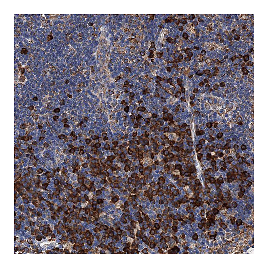Atlas Antibodies Anti-HSPA5 Antibody