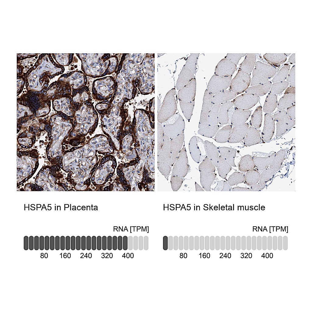 Atlas Antibodies Anti-HSPA5 Antibody