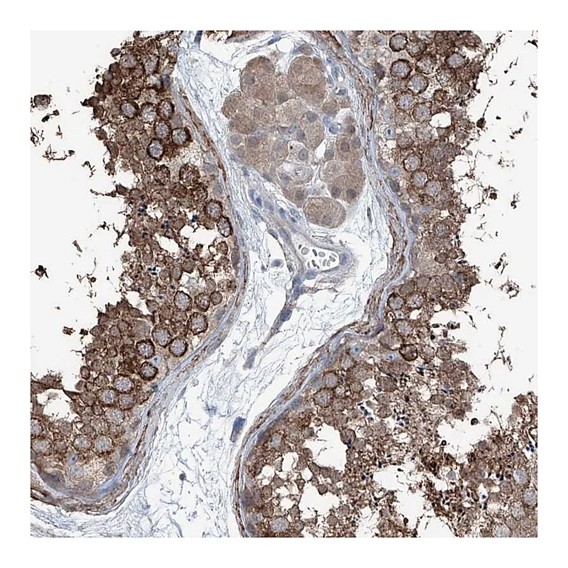 Atlas Antibodies Anti-HSPB11 Antibody
