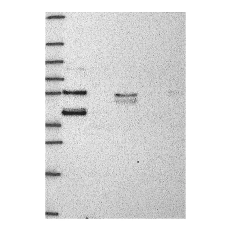 Atlas Antibodies Anti-HSPBP1 Antibody