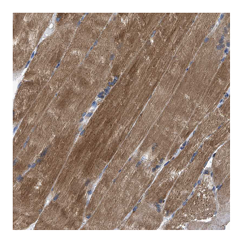Atlas Antibodies Anti-HSPB8 Antibody