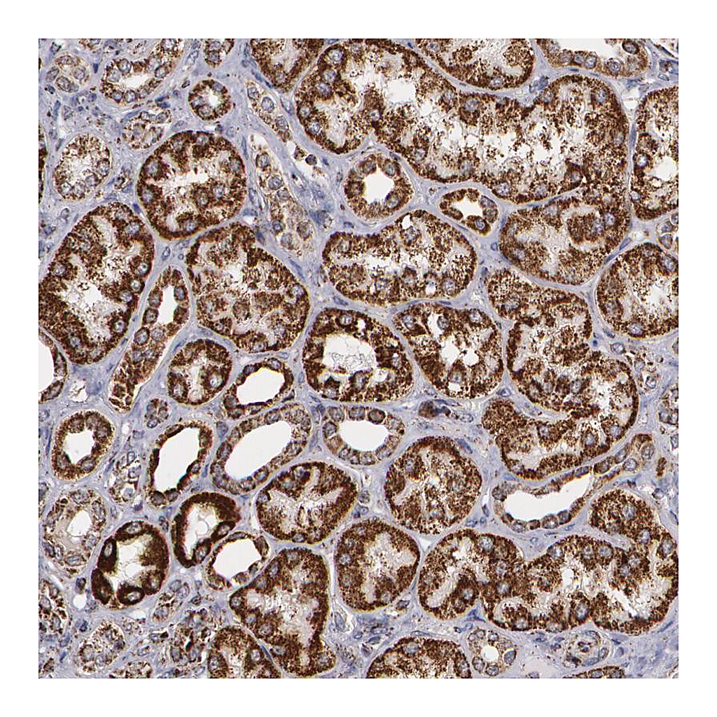 Atlas Antibodies Anti-HSPD1 Antibody