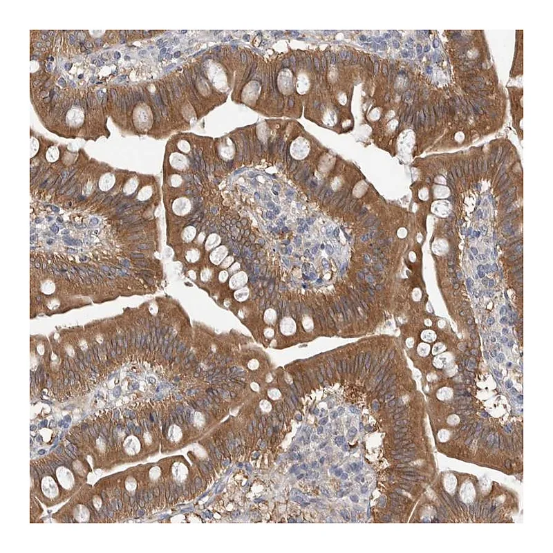 Atlas Antibodies Anti-HTATIP2 Antibody