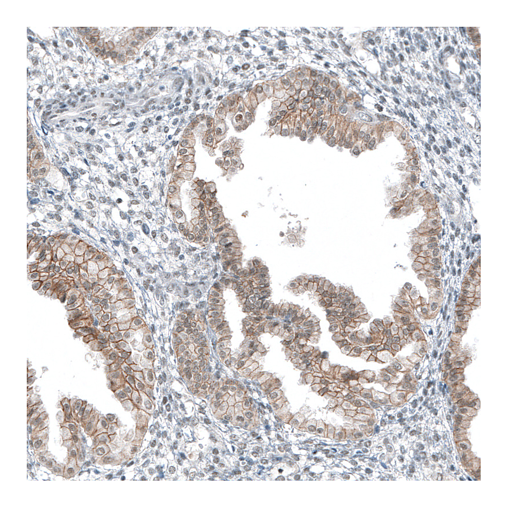 Atlas Antibodies Anti-HTR1E Antibody