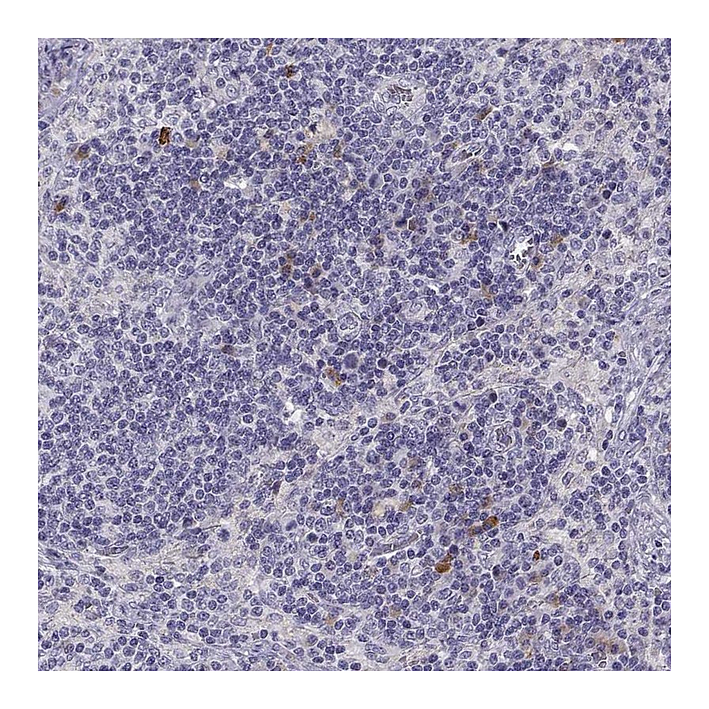 Atlas Antibodies Anti-HTR3A Antibody