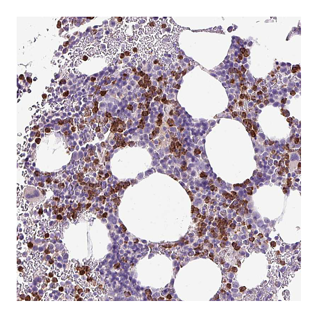 Atlas Antibodies Anti-HTR3E Antibody