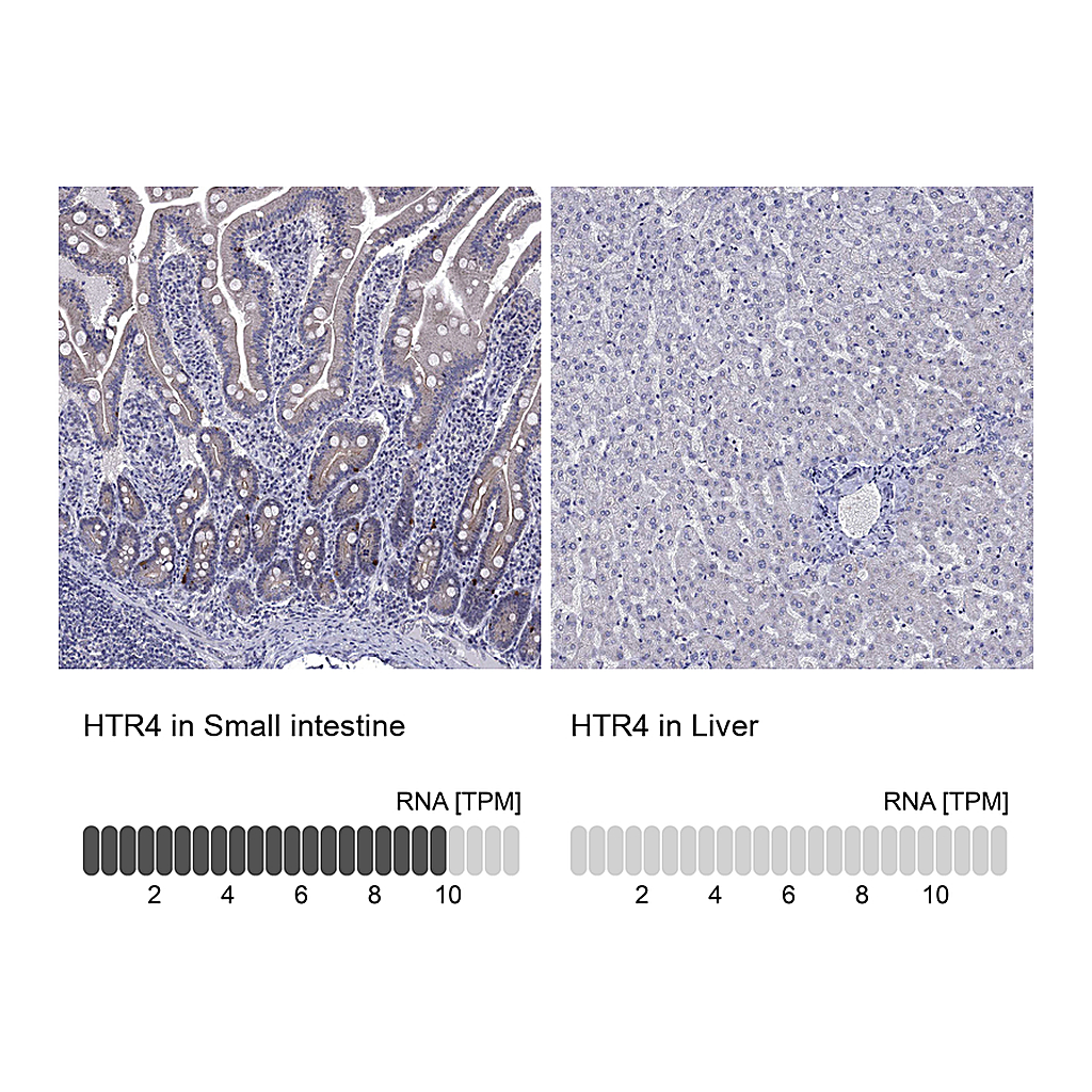 Atlas Antibodies Anti-HTR4 Antibody