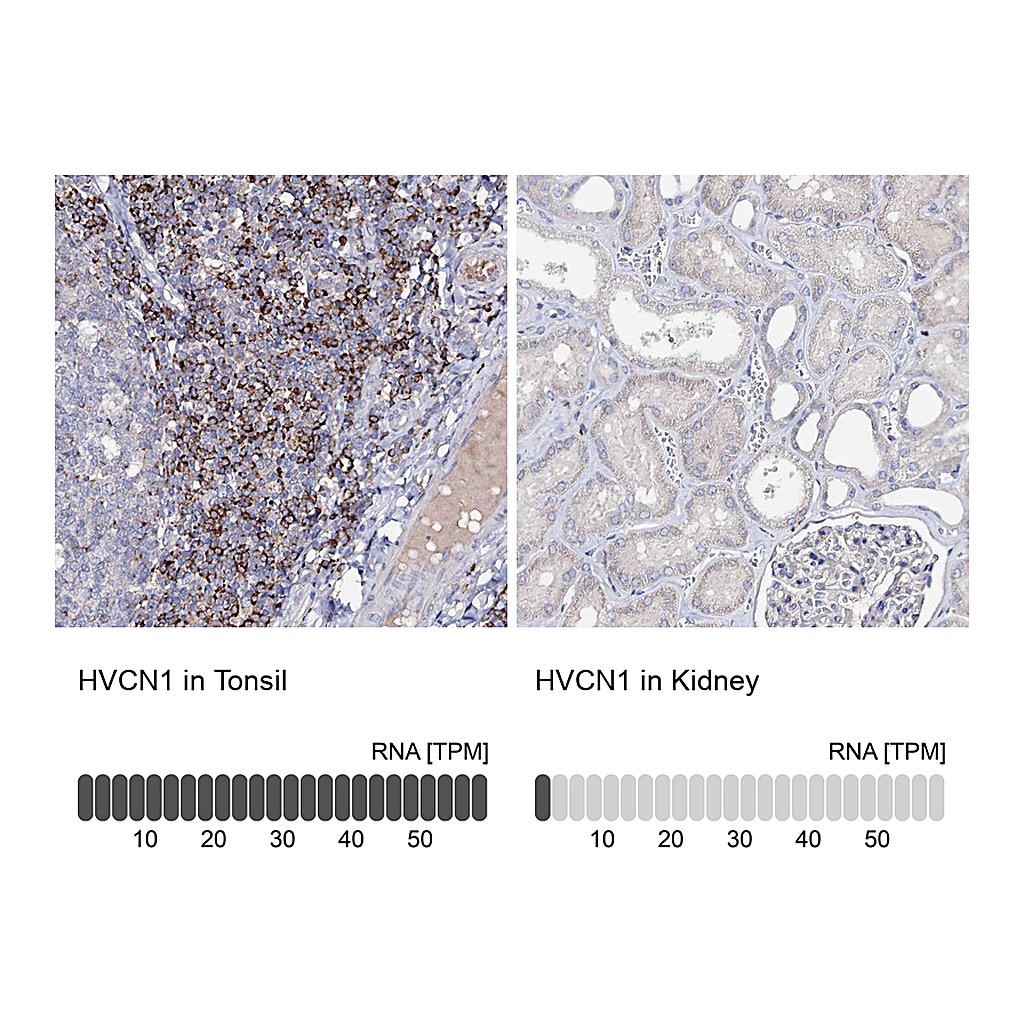 Atlas Antibodies Anti-HVCN1 Antibody