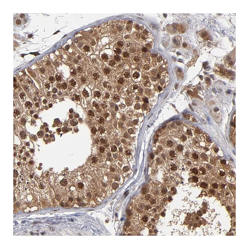 Atlas Antibodies Anti-HUWE1 Antibody