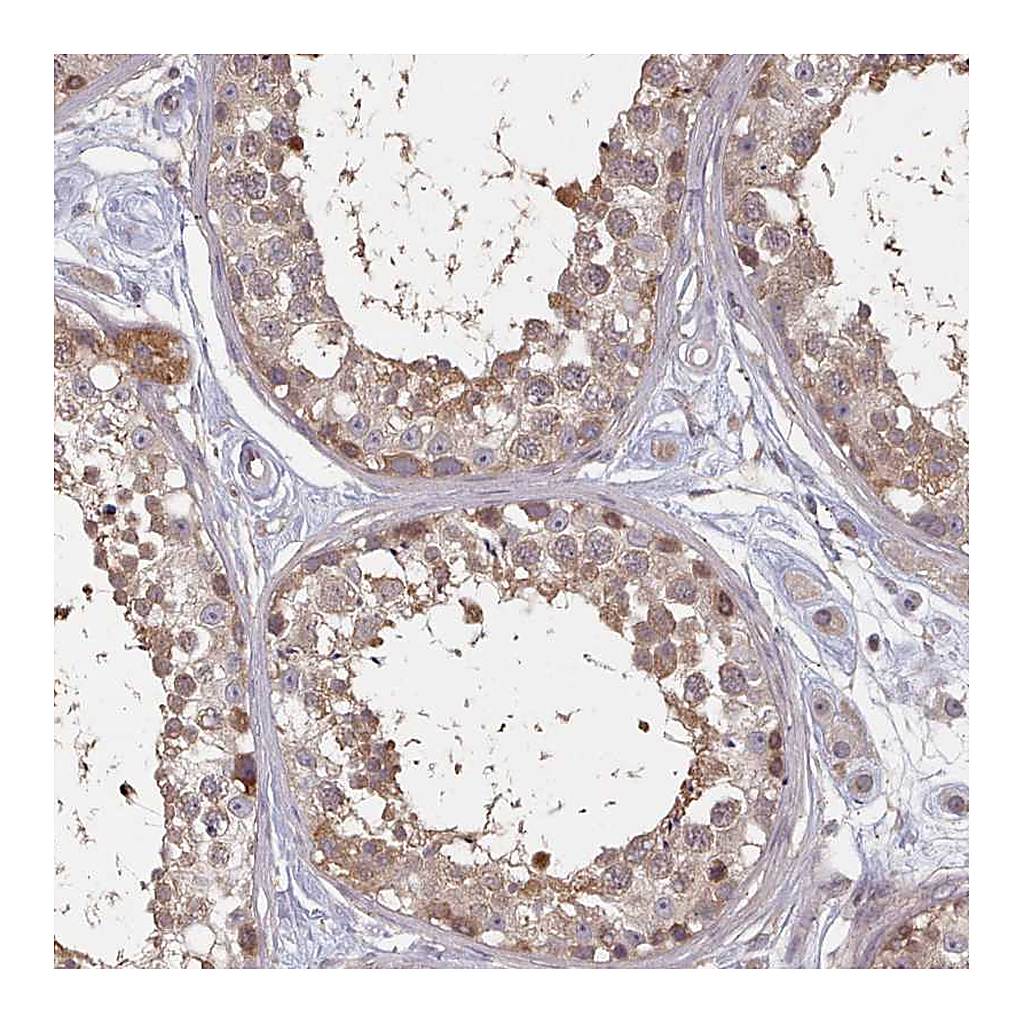 Atlas Antibodies Anti-HYAL3 Antibody