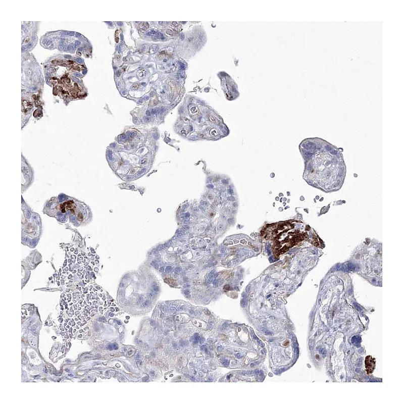 Atlas Antibodies Anti-HYAL2 Antibody