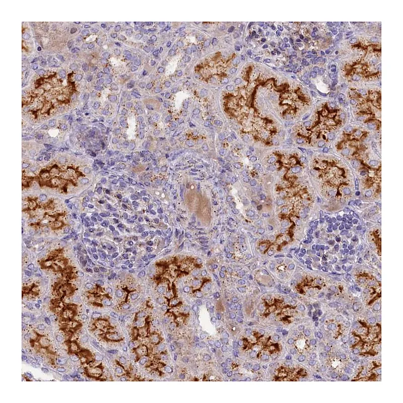 Atlas Antibodies Anti-HYKK Antibody