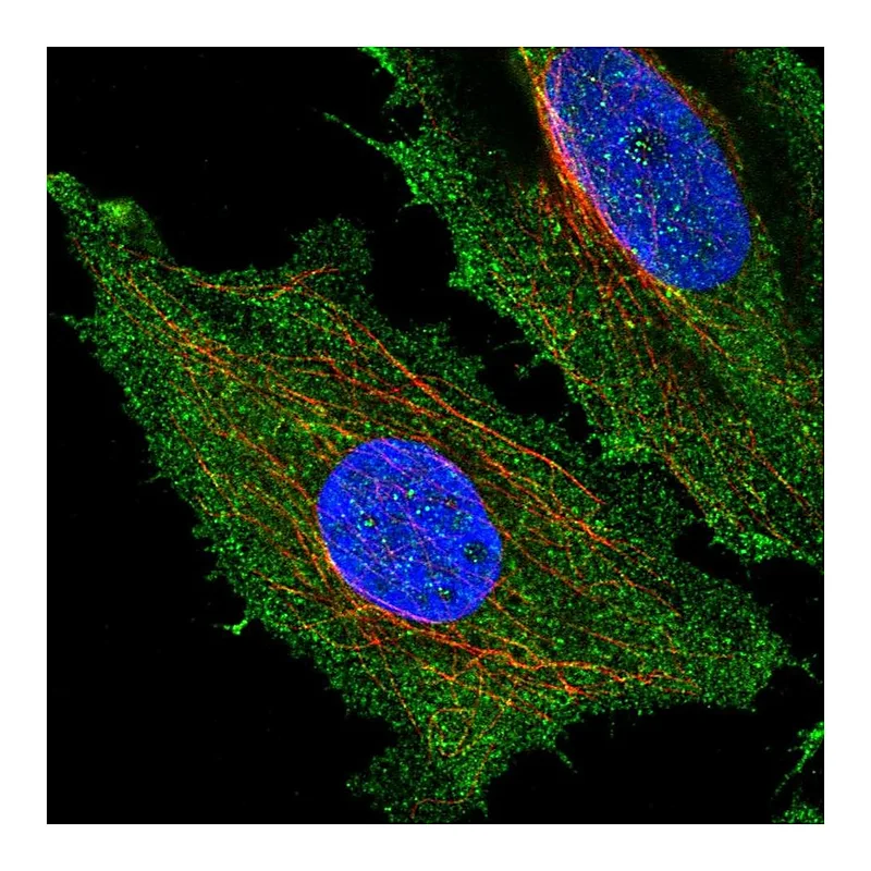 Atlas Antibodies Anti-HYDIN Antibody