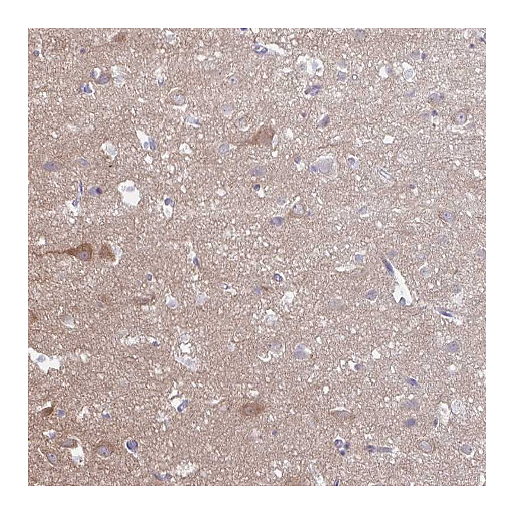 Atlas Antibodies Anti-HYPK Antibody