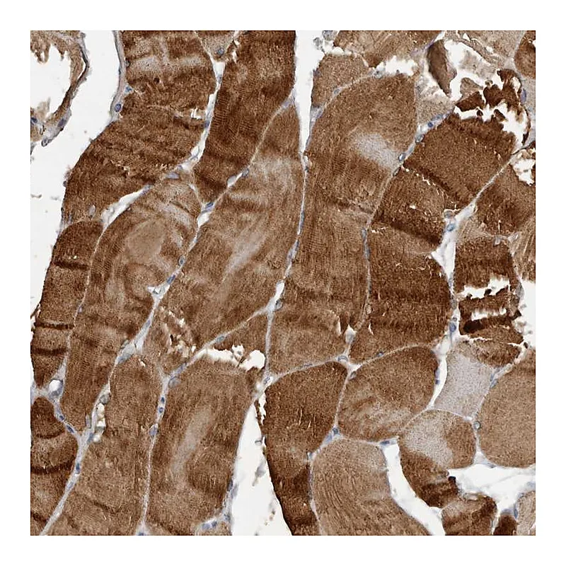 Atlas Antibodies Anti-HYAL4 Antibody