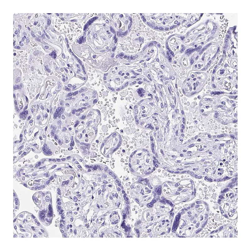 Atlas Antibodies Anti-IAPP Antibody