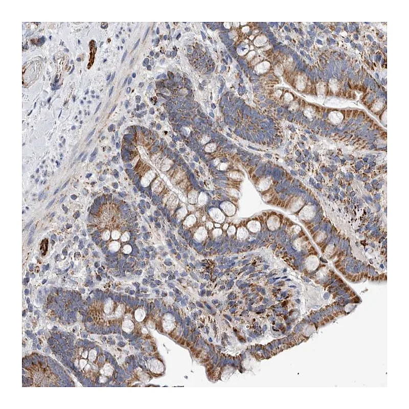 Atlas Antibodies Anti-IARS2 Antibody