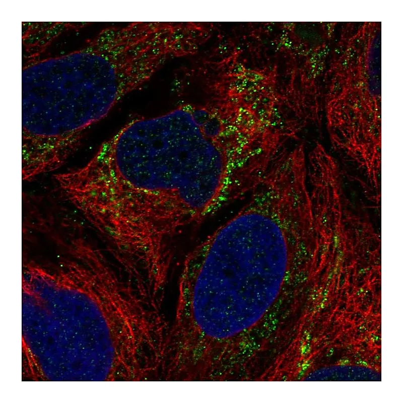Atlas Antibodies Anti-IBA57 Antibody