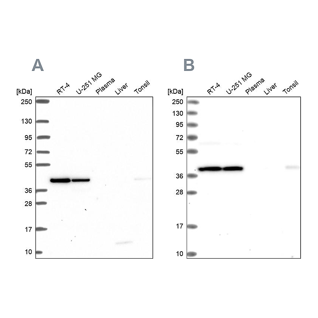 Atlas Antibodies Anti-IDH3A Antibody
