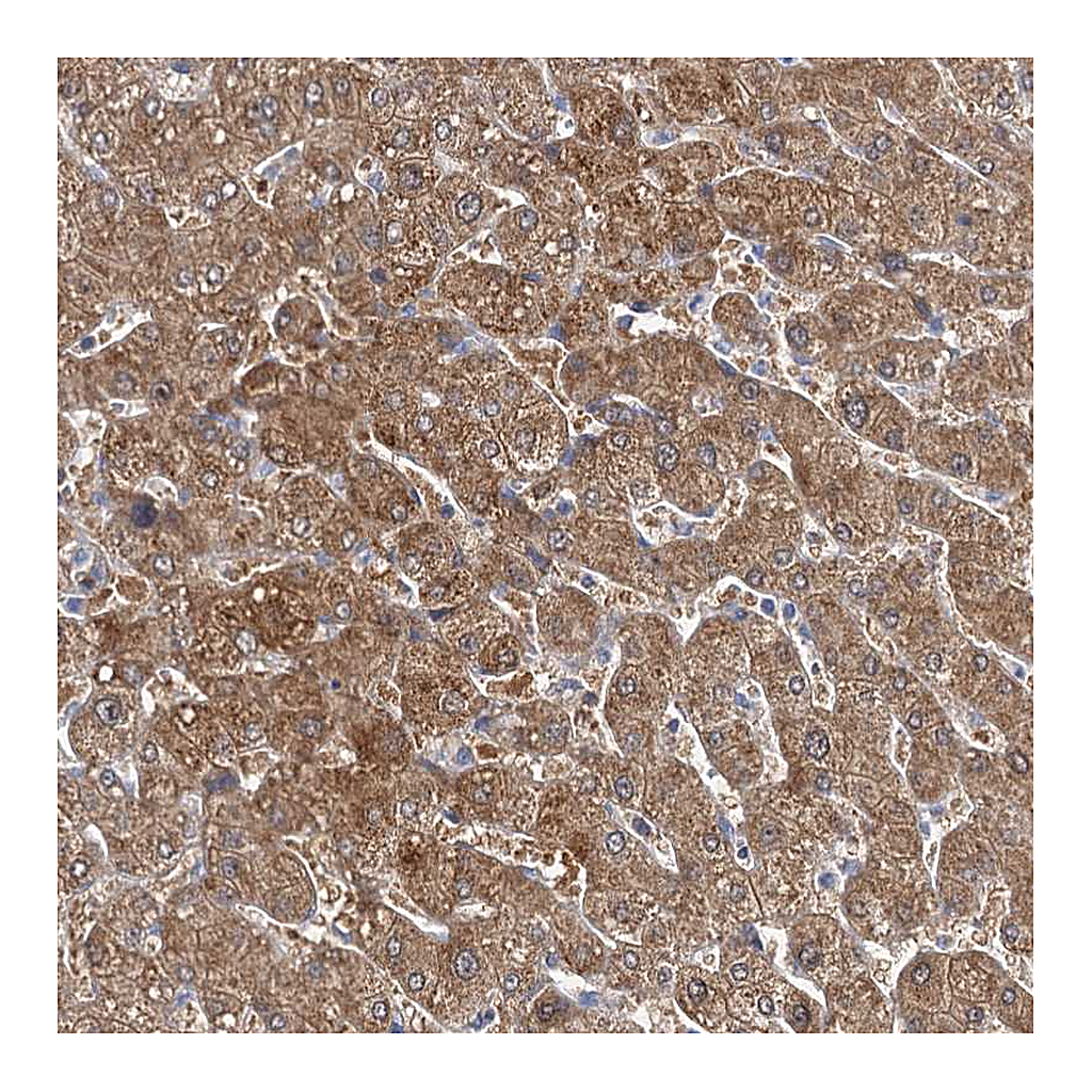 Atlas Antibodies Anti-IDI1 Antibody