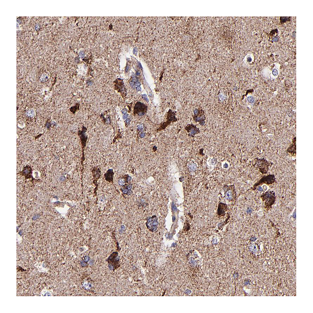 Atlas Antibodies Anti-IDH3G Antibody