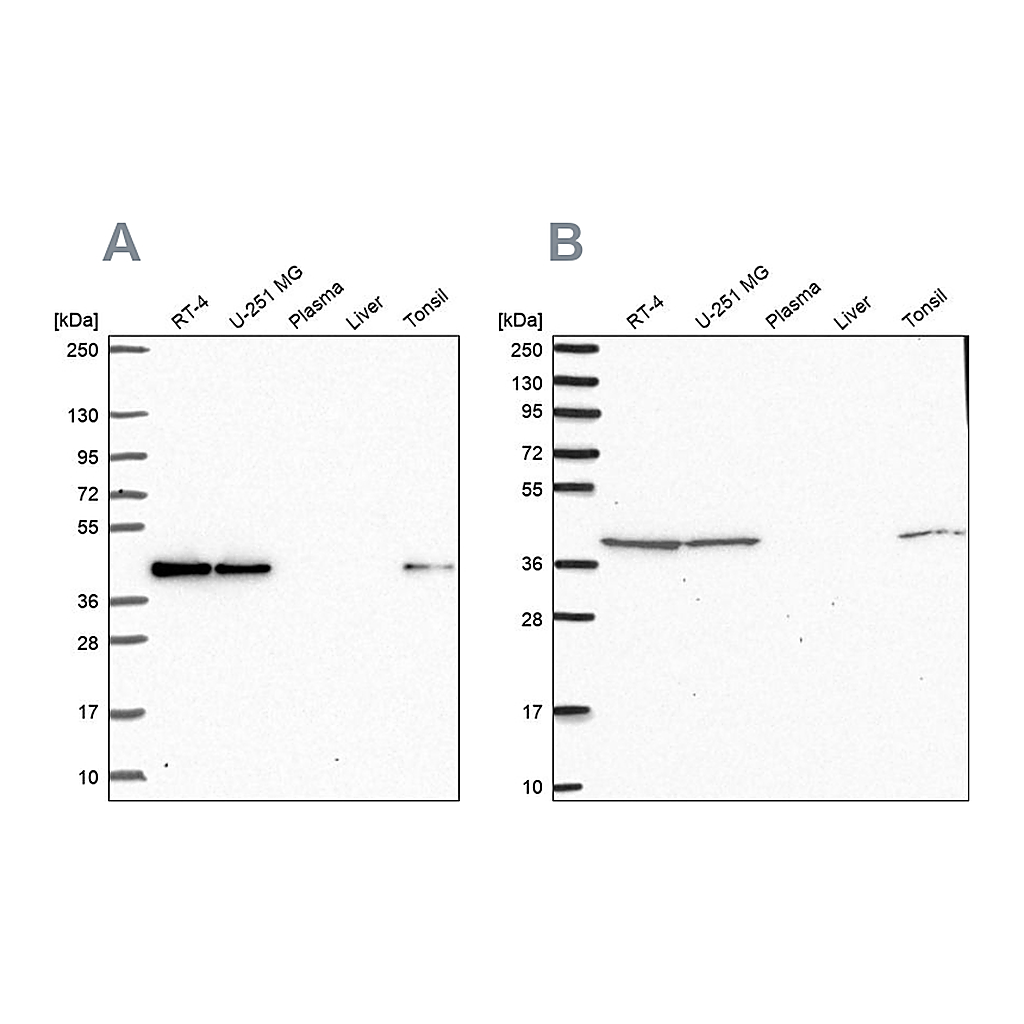 Atlas Antibodies Anti-IDH3B Antibody