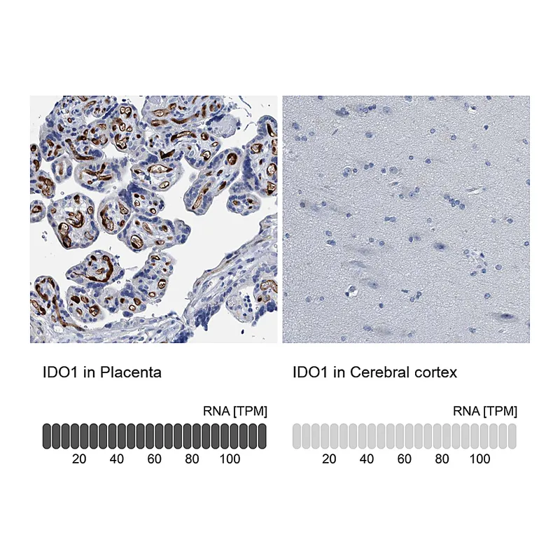 Atlas Antibodies Anti-IDO1 Antibody